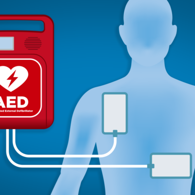 Importance of Automated External Defibrillators (AEDs)